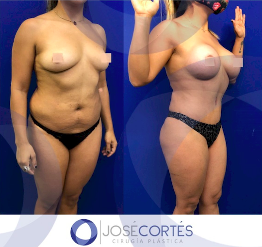 alessandra jimenez add mexican fat tits photo