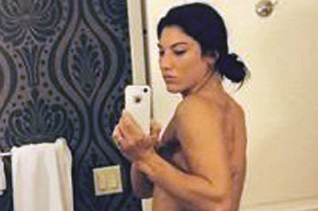 doug slyman add hope solo nude pics photo